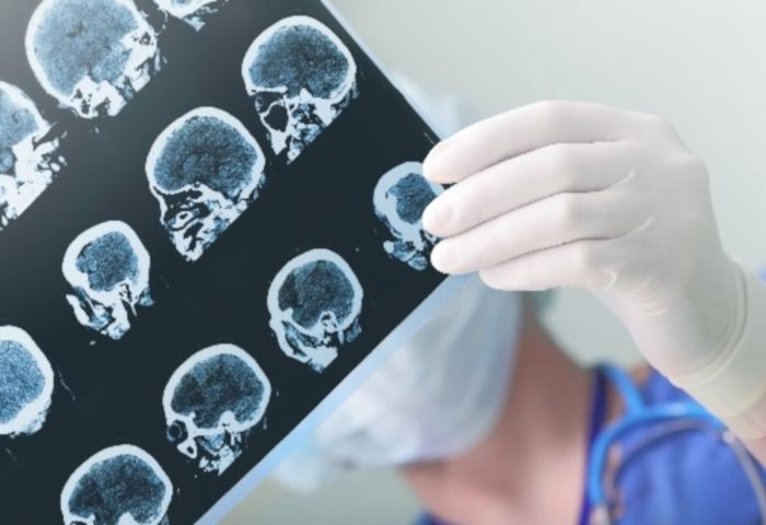 Ambulatorio epilessia e monitoraggio delle 24h del sonno