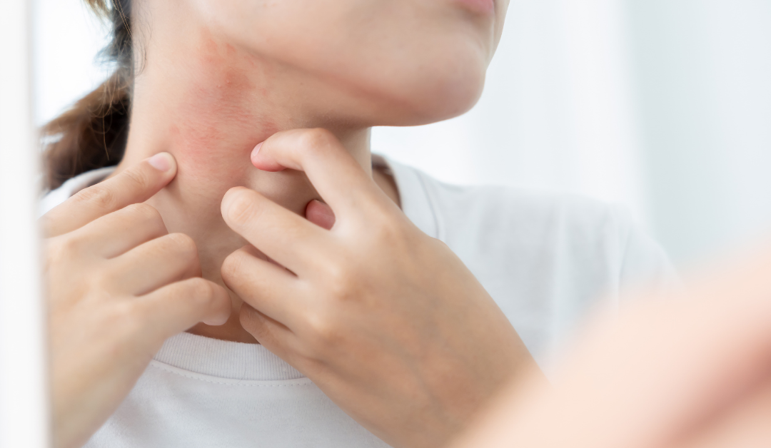 Primavera in Salute: Sabato 18 aprile, consulti gratuiti con il Dermatologo a La Spezia